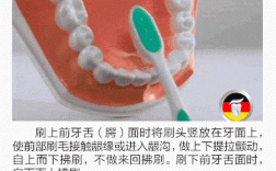 舌侧正畸刷牙方法