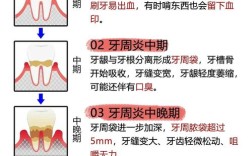 严重牙周炎的治疗方法