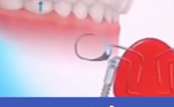 磨牙后推正畸过程是怎样的？步骤和效果如何？