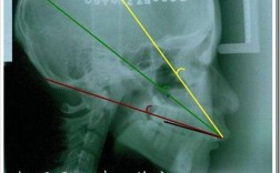 正畸阻抗中心，牙齿移动的力学支点是什么？