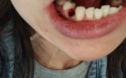 拔牙后正畸牙齿会疼吗