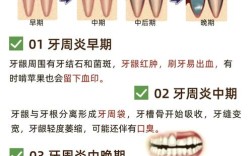 治疗牙周炎的小方法，日常怎么用才有效？