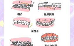 正畸打钢钉什么时候打