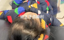 49岁想做牙齿正畸，这个年龄矫正还来得及吗？