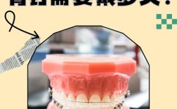 正畸需要打钉子吗