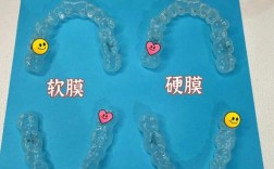 时代天使矫正牙齿效果