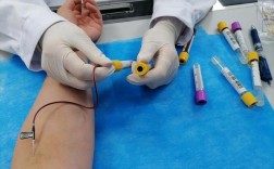 四医大正畸为何要验血？