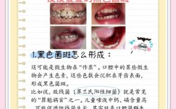 牙上长黑点解决方法