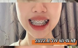 30岁还能矫正牙齿吗？