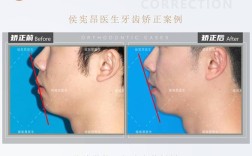 正畸Tweed是谁？正畸领域的关键技术揭秘