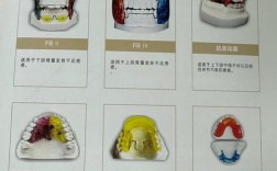 正畸功能矫正器制作的关键方法是什么？