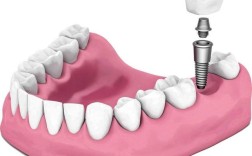 缺牙可以做牙齿矫正吗？矫正效果会受影响吗？