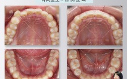 成都正畸详询华美6