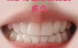 12岁牙齿矫正一般需要多久？