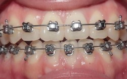 龙岩牙齿正畸去哪里做？求推荐靠谱口腔机构