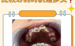 儿童矫正牙齿的最佳年龄，到底是几岁呢？