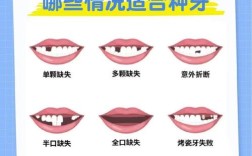 下牙床缺失能种牙吗？