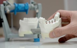 3D打印牙齿矫正器相比传统有何矫正优势？