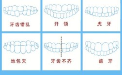牙齿矫正一次性收费真的划算吗？有哪些注意事项？