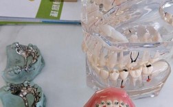 矫正牙齿材料图里有哪些材料？如何选择合适的？