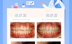 正畸牙医分享案例