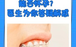 怀孕期间能做牙齿矫正吗？安全注意事项有哪些？