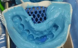 牙科取模的正确方法是什么？步骤要点有哪些？