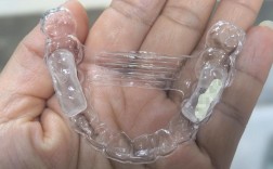 牙套矫正牙齿真的有效吗？效果和安全性如何？