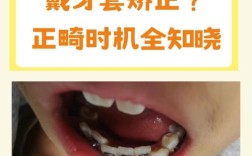 零基础想矫正牙齿，可行吗？