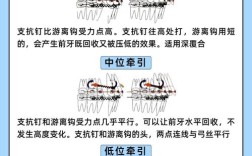 种植钉植入方法的具体操作步骤是什么？