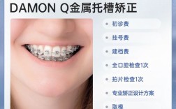 拜博矫正牙齿怎么样？效果、体验和口碑真实情况如何？