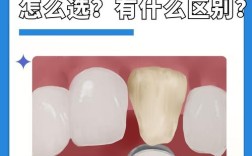 种牙与烤瓷牙的差别具体体现在哪？哪种更适合修复牙齿？