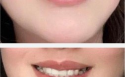 北京哪儿种牙最好