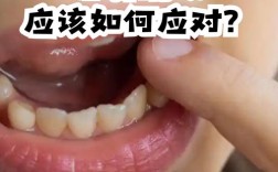 牙齿矫正门牙摇动是正常现象吗？需要处理吗？