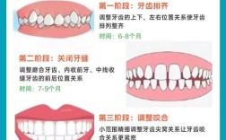 牙齿矫正可以分期吗？费用怎么算，流程是怎样的？