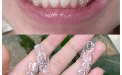 北京牙齿矫正去哪里做比较好？