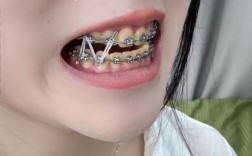 牙齿矫正不用矫正器？这些新方法靠谱吗？