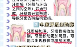 齿周病有哪些有效治疗方法？