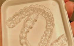 正畸后保持器 更换