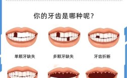 哪一种牙最后用