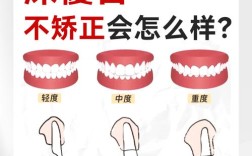 正畸可以治深覆合吗