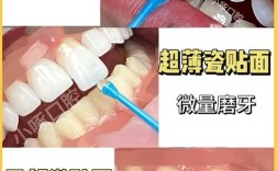 临时牙贴面的制作方法是什么？步骤有哪些？