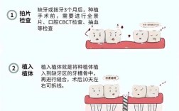 种牙是否可以不佩戴牙套直接完成整个种植过程呢？