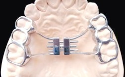 口腔正畸功能调节器