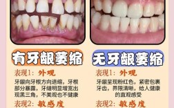 牙龈萎缩患者能否进行牙齿矫正？
