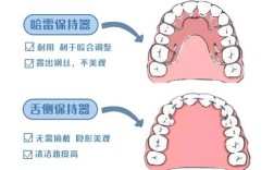 正畸保持的含义是什么？它为何不可或缺？
