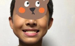 美奥口腔儿童正畸