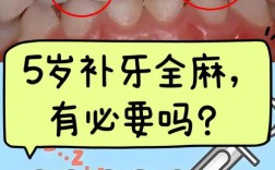 儿童种牙有必要吗？家长必知的适应症、时机及重要性