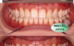 正畸手术失败案例频发，背后原因究竟何在？