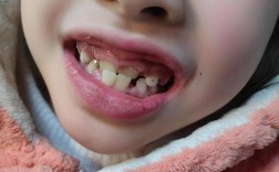 正畸牙齿 要出国